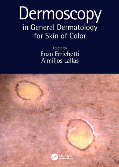 bokomslag Dermoscopy in General Dermatology for Skin of Color