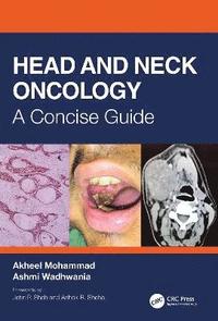 bokomslag Head and Neck Oncology