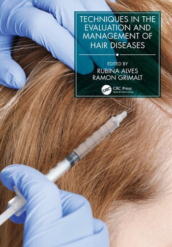Rubina Alves, Ramon Grimalt - Techniques in the Evaluation and Management of Hair Diseases, Inbunden