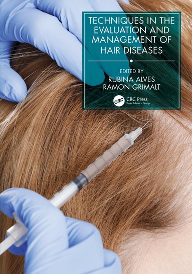 Rubina Alves, Ramon Grimalt - Techniques in the Evaluation and Management of Hair Diseases, Häftad