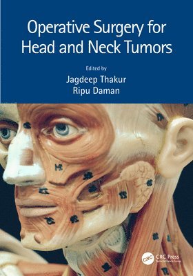 Jagdeep Thakur, Ripu Daman Arora, India) Thakur, Jagdeep (Indira Gandhi Medical College, India.) Arora, Ripu Daman (AIIMS, Raipur - Operative Surgery for Head and Neck Tumors, Inbunden