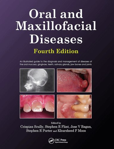 Crispian Scully, Stephen Flint - Oral and Maxillofacial Diseases, Fourth Edition, Häftad