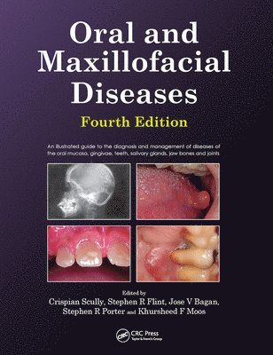 bokomslag Oral and Maxillofacial Diseases