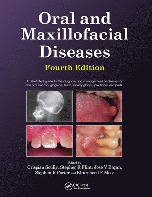 Oral and Maxillofacial Diseases, Fourth Edition 1