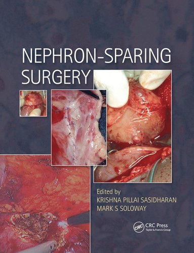 bokomslag Nephron-Sparing Surgery