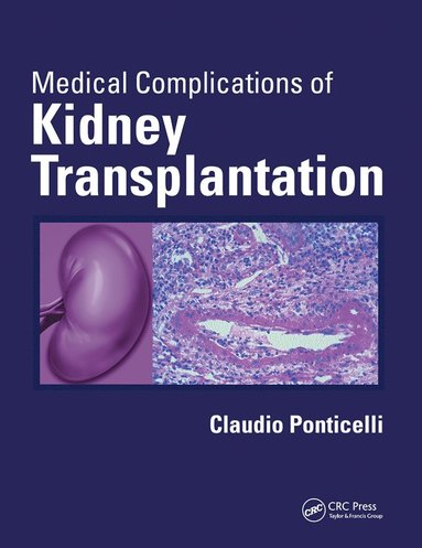 bokomslag Medical Complications of Kidney Transplantation