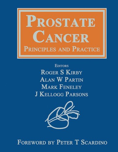 bokomslag Prostate Cancer