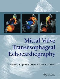 bokomslag Mitral Valve Transesophageal Echocardiography