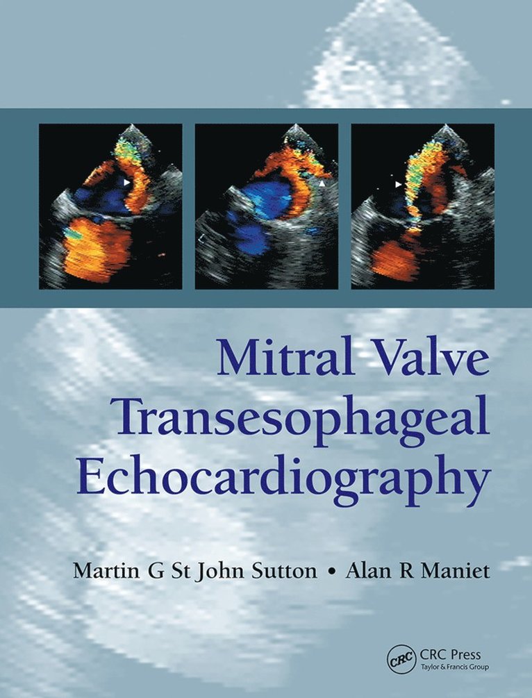 Martin G. St. John Sutton, Alan R. Maniet, Martin G. St John Sutton - Mitral Valve Transesophageal Echocardiography, Häftad