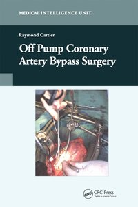 bokomslag Off-Pump Coronary Artery Bypass Surgery