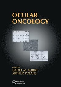 bokomslag Ocular Oncology