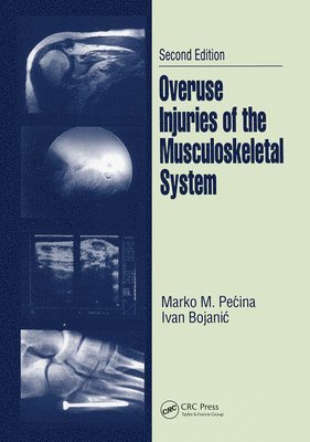 Overuse Injuries of the Musculoskeletal System 1