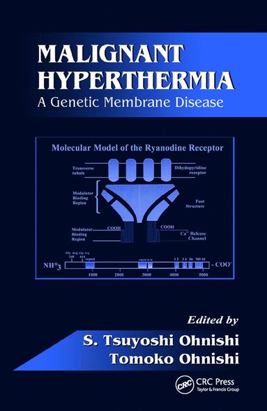 bokomslag Malignant Hyperthermia