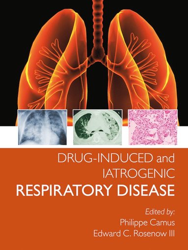 bokomslag Drug-induced and Iatrogenic Respiratory Disease