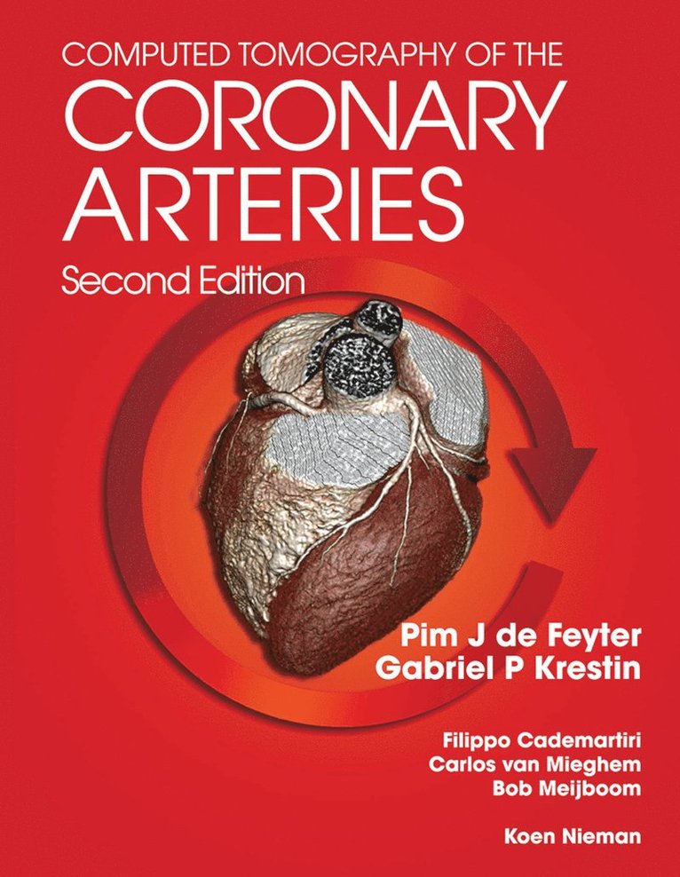 Pim J. de Feyter, G. P. Gabriel Krestin - Computed Tomography of the Coronary Arteries, Häftad
