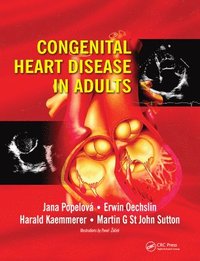 bokomslag Congenital Heart Disease in Adults
