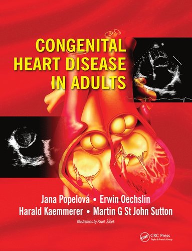 bokomslag Congenital Heart Disease in Adults