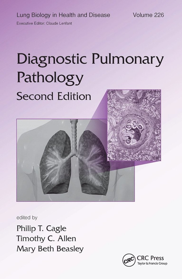 Philip T. Cagle, Timothy C. Allen, Mary Beth Beasley - Diagnostic Pulmonary Pathology, Häftad