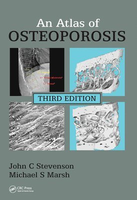 John C. Stevenson, Michael S. Marsh - Atlas of Osteoporosis, Häftad