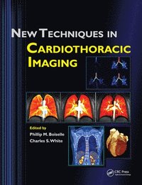 bokomslag New Techniques in Cardiothoracic Imaging
