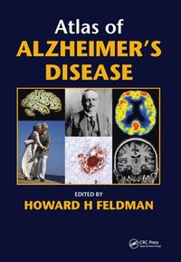 bokomslag Atlas of Alzheimer's Disease