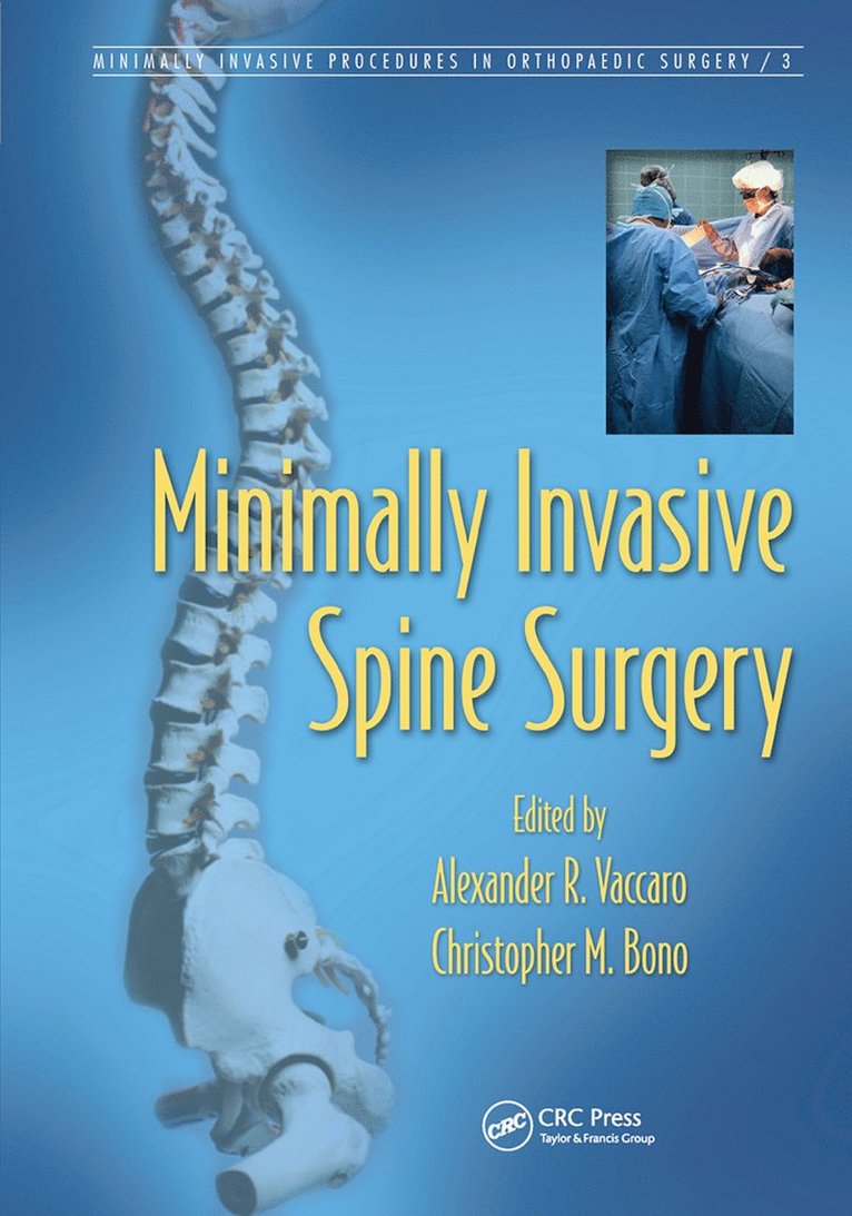 Alexander R. Vaccaro, Christopher M. Bono - Minimally Invasive Spine Surgery, Häftad