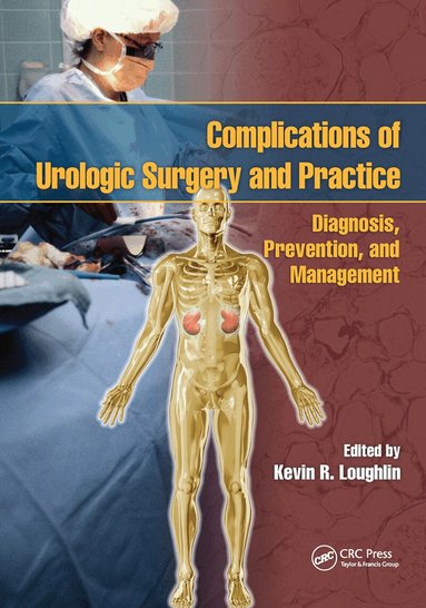Kevin R. Loughlin - Complications of Urologic Surgery and Practice, Häftad