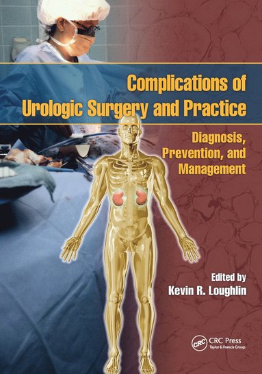 bokomslag Complications of Urologic Surgery and Practice