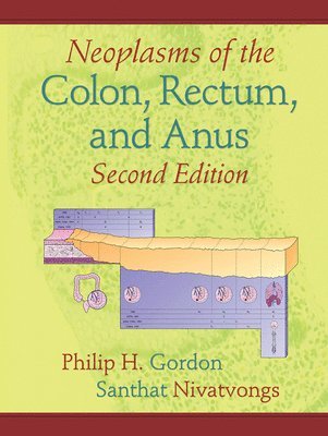 Neoplasms of the Colon, Rectum, and Anus