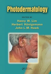 bokomslag Photodermatology