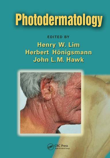 Henry W. Lim, Herbert Honigsmann, John L. M. Hawk - Photodermatology, Häftad