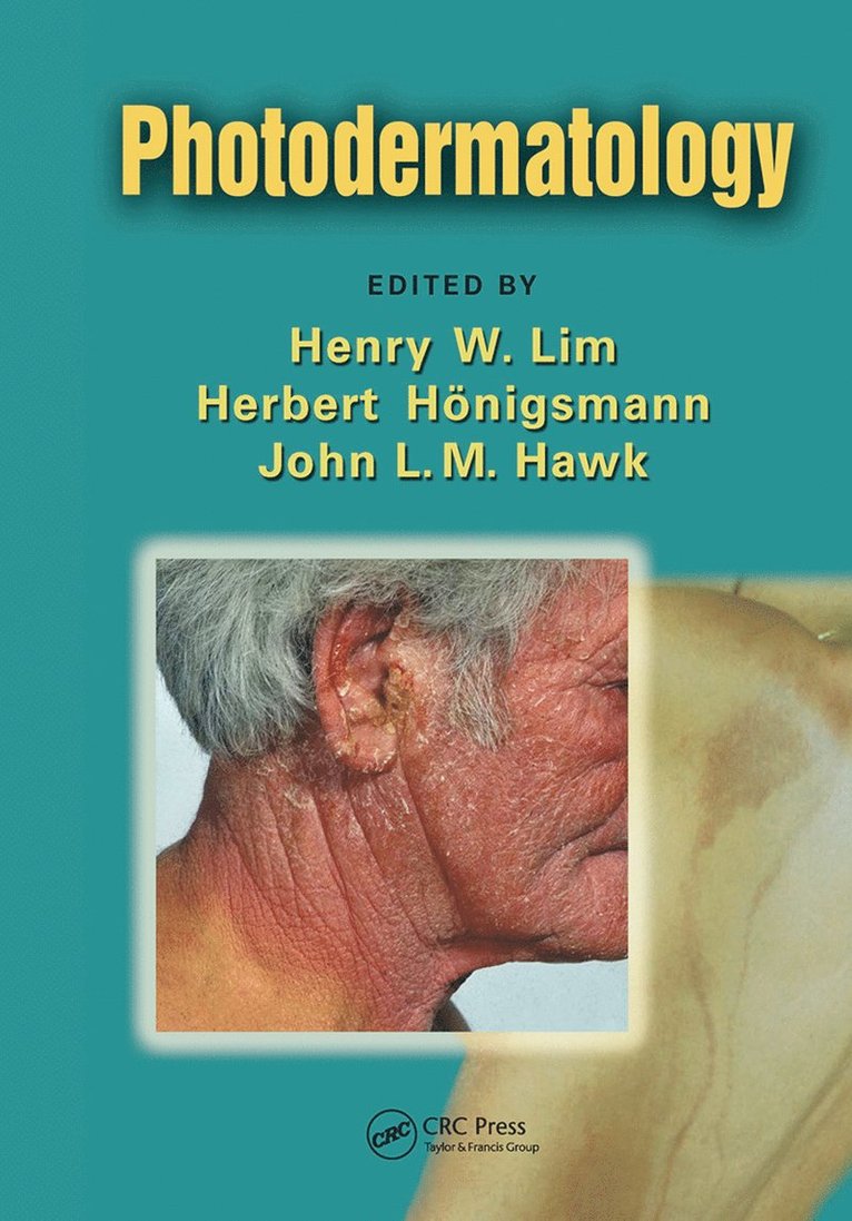 Henry W. Lim, Herbert Honigsmann, John L. M. Hawk - Photodermatology, Häftad