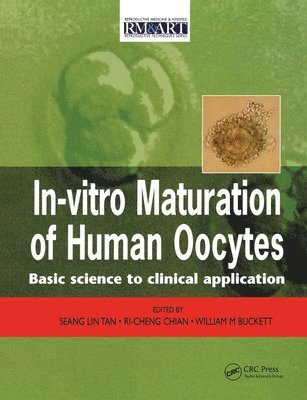 In Vitro Maturation of Human Oocytes 1