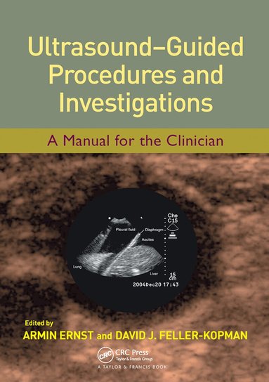 Armin Ernst, David J. Feller-Kopman - Ultrasound-Guided Procedures and Investigations, Häftad