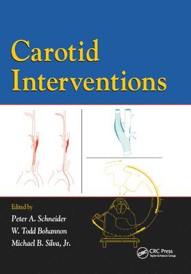 bokomslag Carotid Interventions