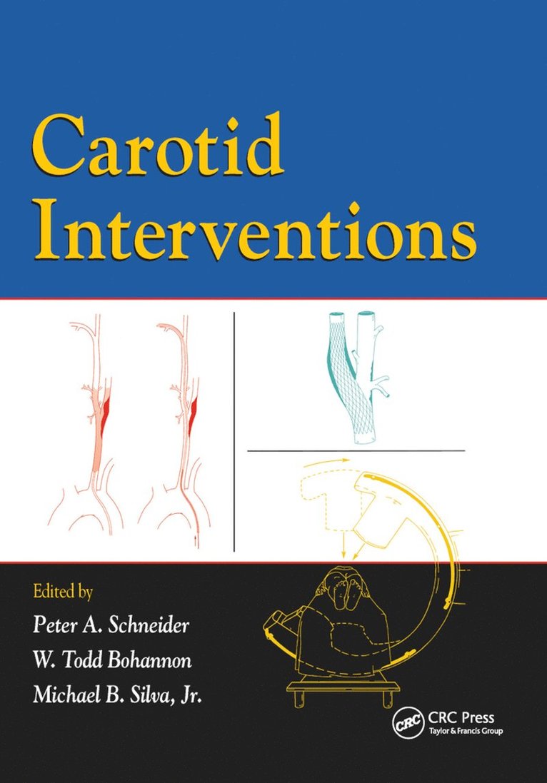 Carotid Interventions 1