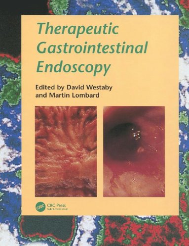 bokomslag Therapeutic Gastrointestinal Endoscopy