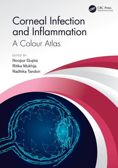 bokomslag Corneal Infection and Inflammation