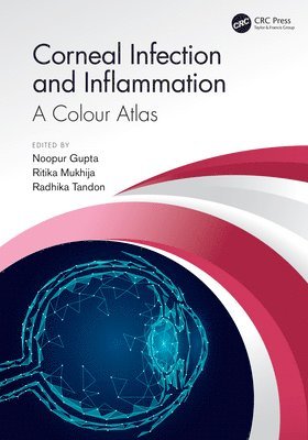 Corneal Infection and Inflammation 1