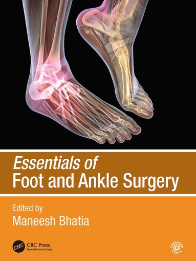 bokomslag Essentials of Foot and Ankle Surgery