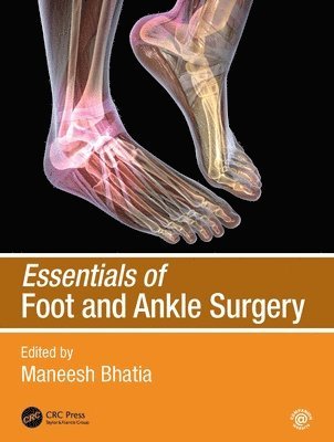 Essentials of Foot and Ankle Surgery 1