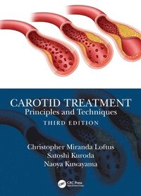 bokomslag Carotid Treatment: Principles and Techniques