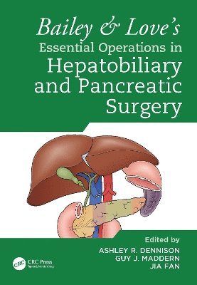 Bailey & Love's Essential Operations in Hepatobiliary and Pancreatic Surgery 1