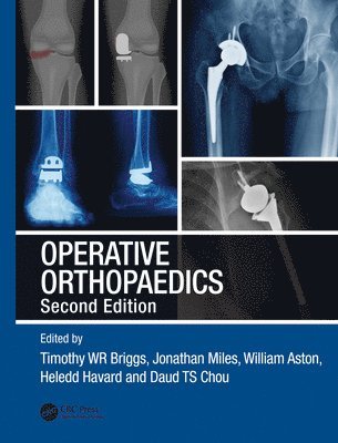 bokomslag Operative Orthopaedics