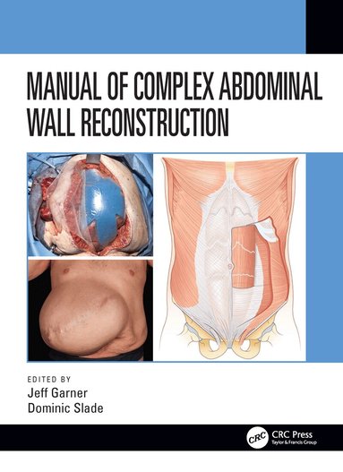 Jeff Garner, Dominic Slade - Manual of Complex Abdominal Wall Reconstruction, Inbunden