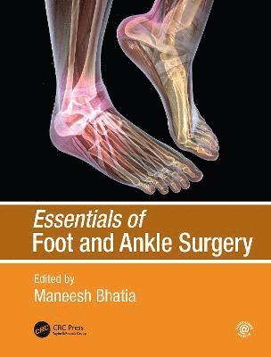 bokomslag Essentials of Foot and Ankle Surgery