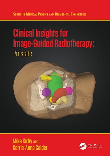 Mike Kirby, Kerrie-Anne Calder - Clinical Insights for Image-Guided Radiotherapy, Häftad