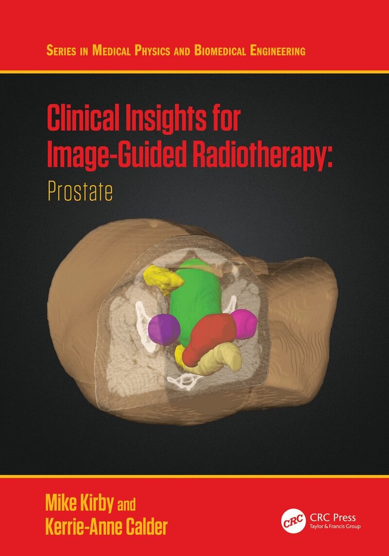 Mike Kirby, Kerrie-Anne Calder - Clinical Insights for Image-Guided Radiotherapy, Häftad
