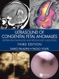 bokomslag Ultrasound of Congenital Fetal Anomalies