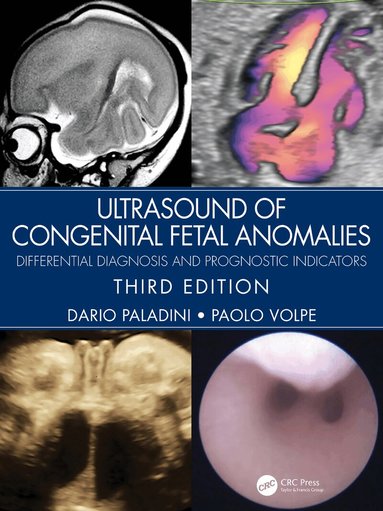 Dario Paladini, Paolo Volpe - Ultrasound of Congenital Fetal Anomalies, Inbunden